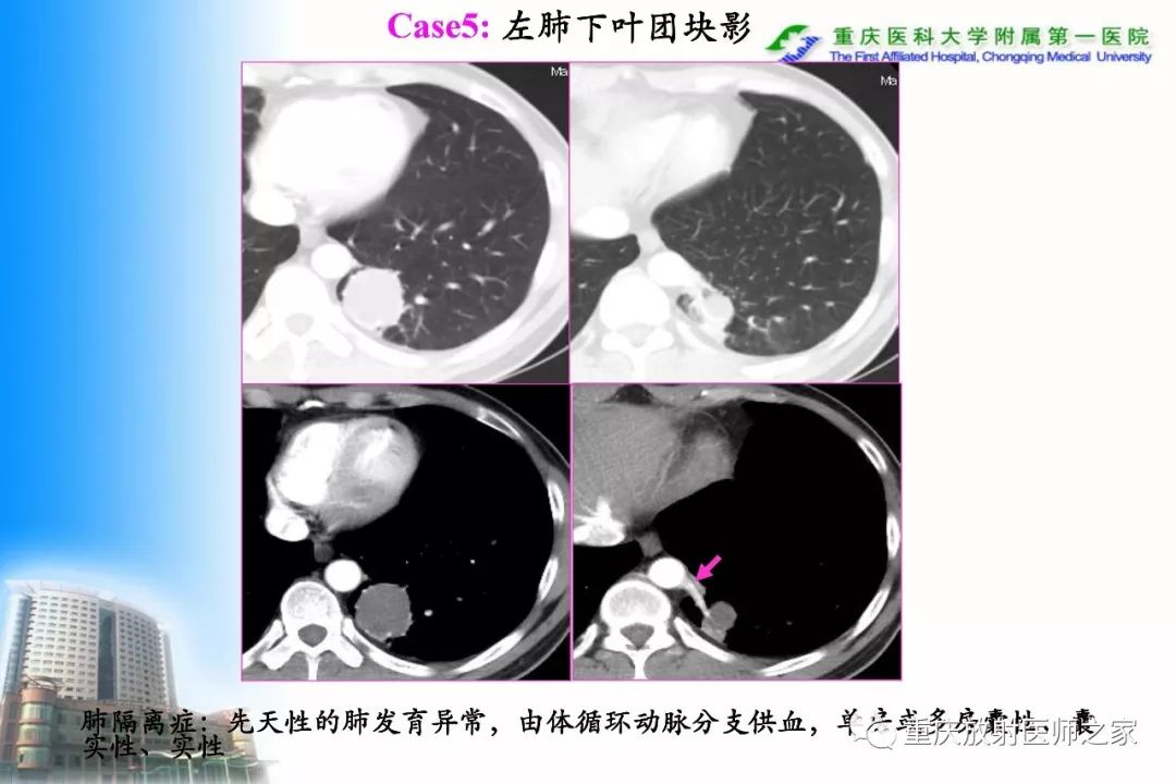 影像PPT - 【PPT】碘对比剂CT增强的影响因素与临床应用-58