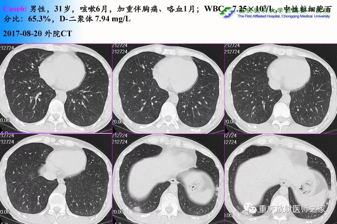 影像PPT - 【PPT】碘对比剂CT增强的影响因素与临床应用-60