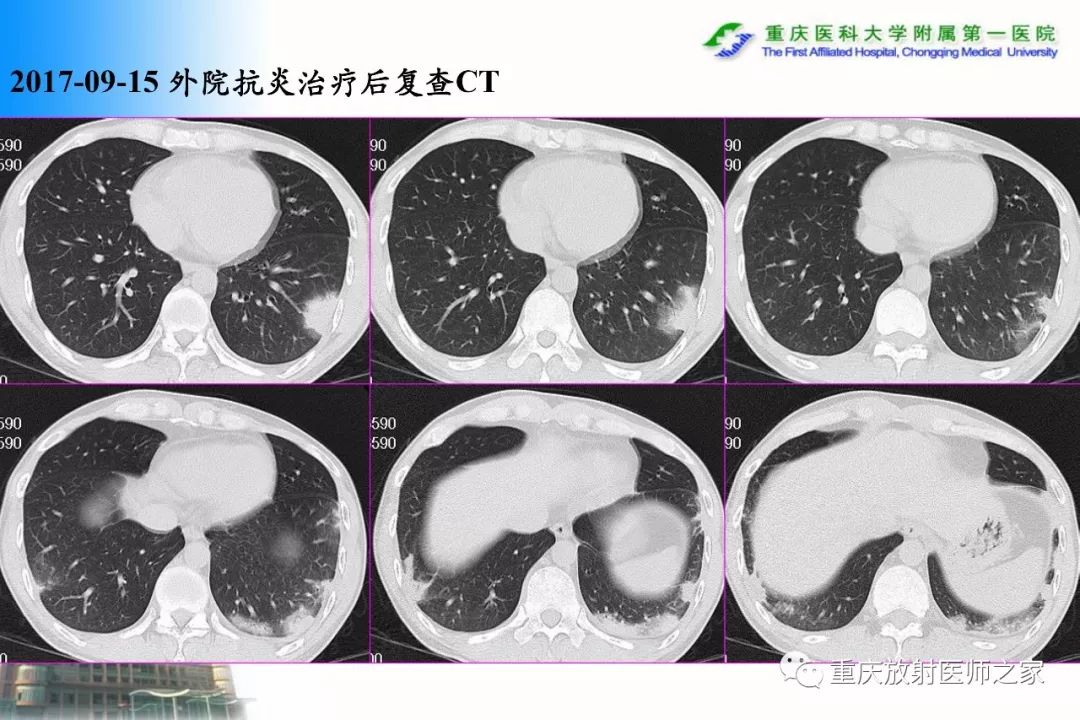影像PPT - 【PPT】碘对比剂CT增强的影响因素与临床应用-61