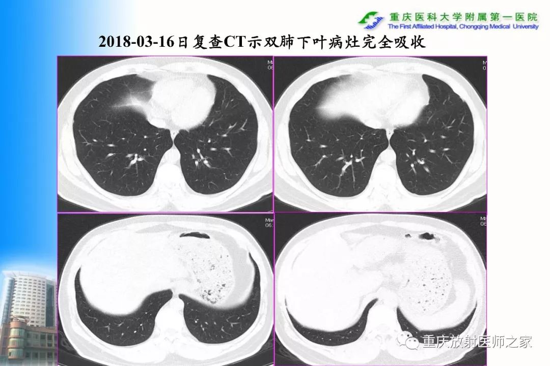 影像PPT - 【PPT】碘对比剂CT增强的影响因素与临床应用-68