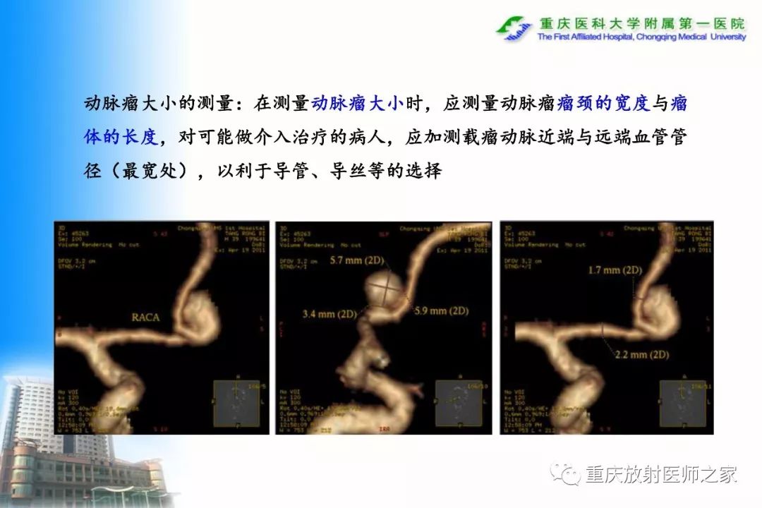 影像PPT - 【PPT】碘对比剂CT增强的影响因素与临床应用-78