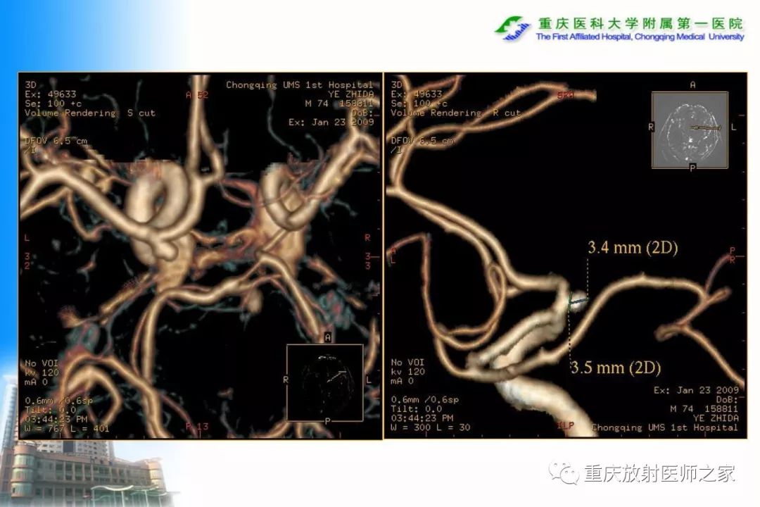 影像PPT - 【PPT】碘对比剂CT增强的影响因素与临床应用-79