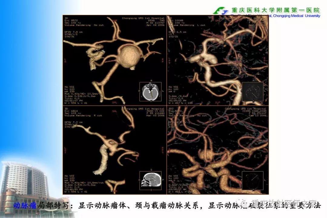 影像PPT - 【PPT】碘对比剂CT增强的影响因素与临床应用-77