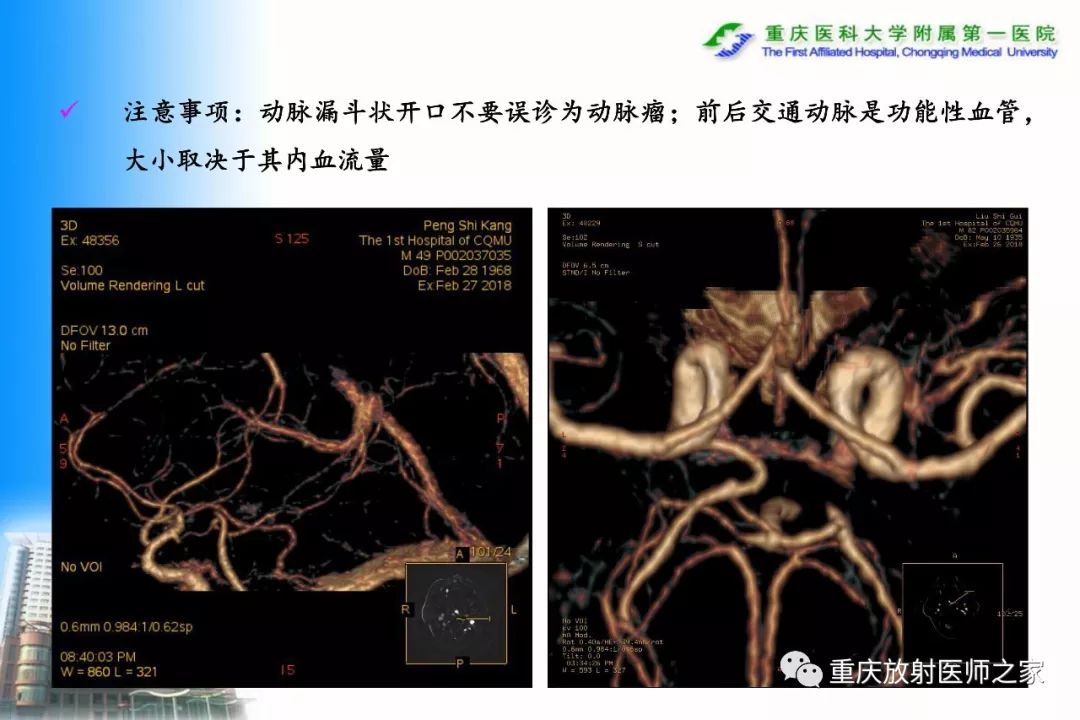 影像PPT - 【PPT】碘对比剂CT增强的影响因素与临床应用-80
