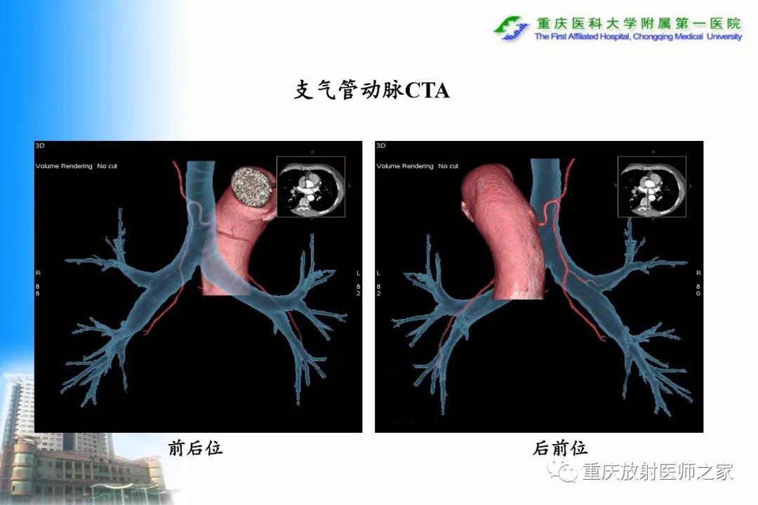 影像PPT - 【PPT】碘对比剂CT增强的影响因素与临床应用-86