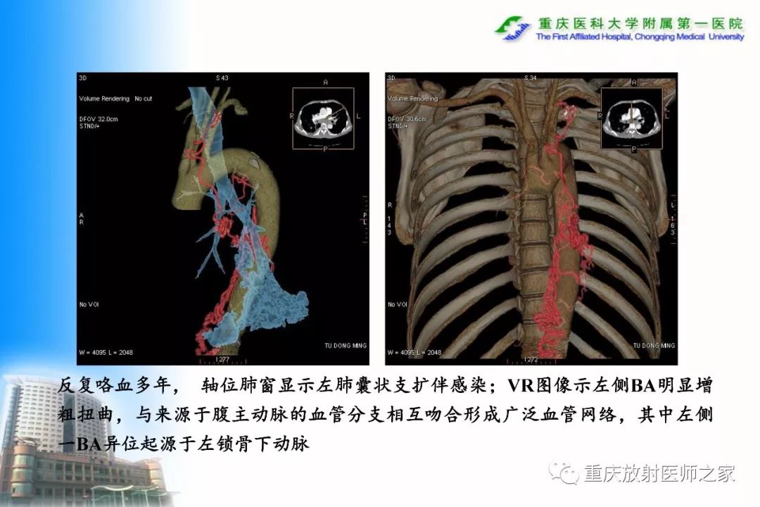 影像PPT - 【PPT】碘对比剂CT增强的影响因素与临床应用-88