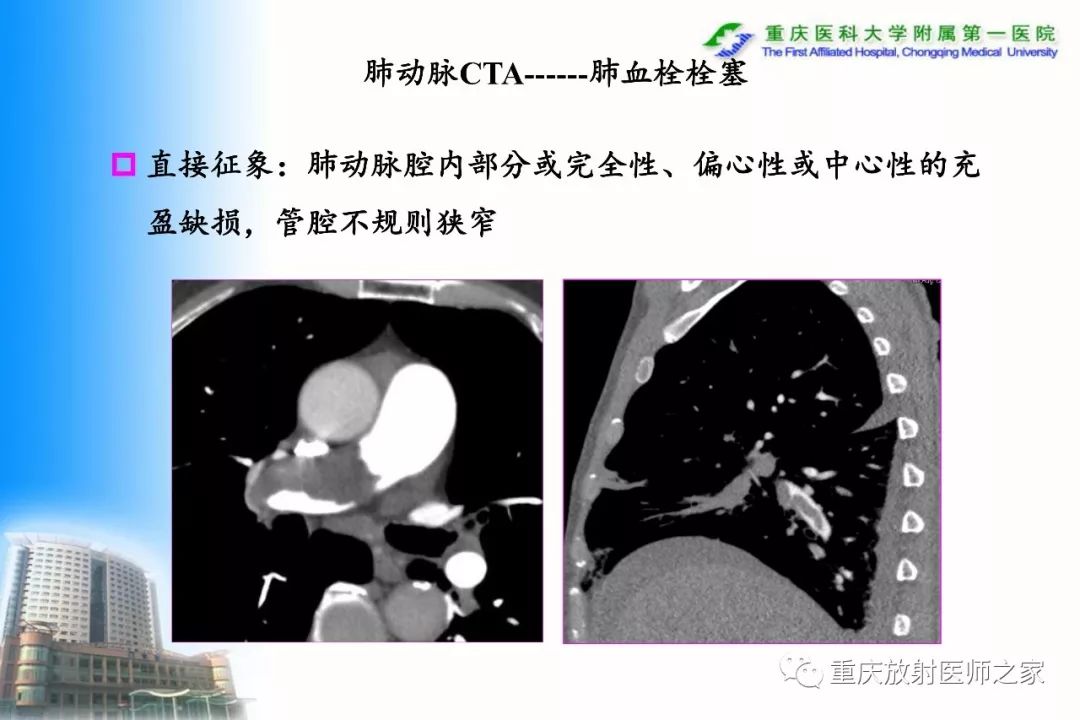 影像PPT - 【PPT】碘对比剂CT增强的影响因素与临床应用-89