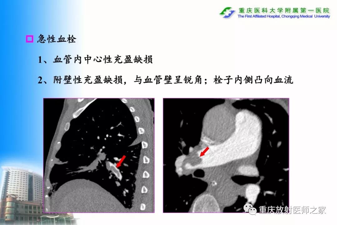 影像PPT - 【PPT】碘对比剂CT增强的影响因素与临床应用-90