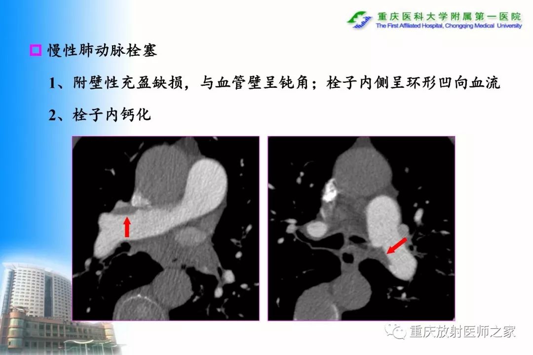 影像PPT - 【PPT】碘对比剂CT增强的影响因素与临床应用-91