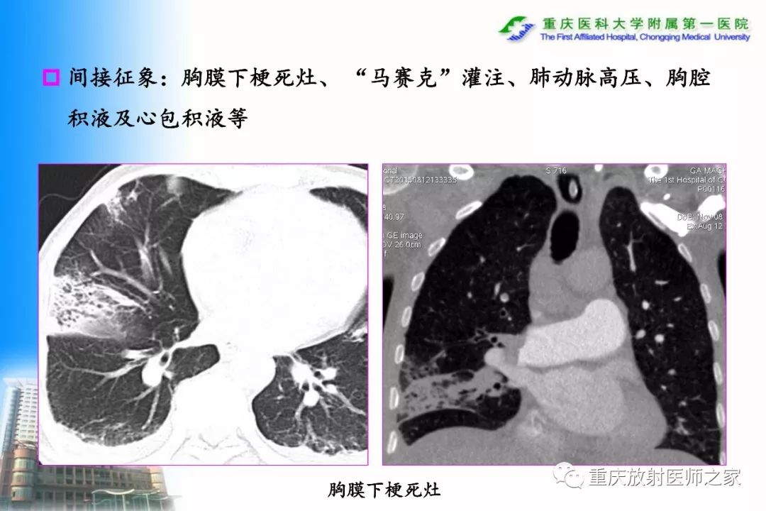 影像PPT - 【PPT】碘对比剂CT增强的影响因素与临床应用-92