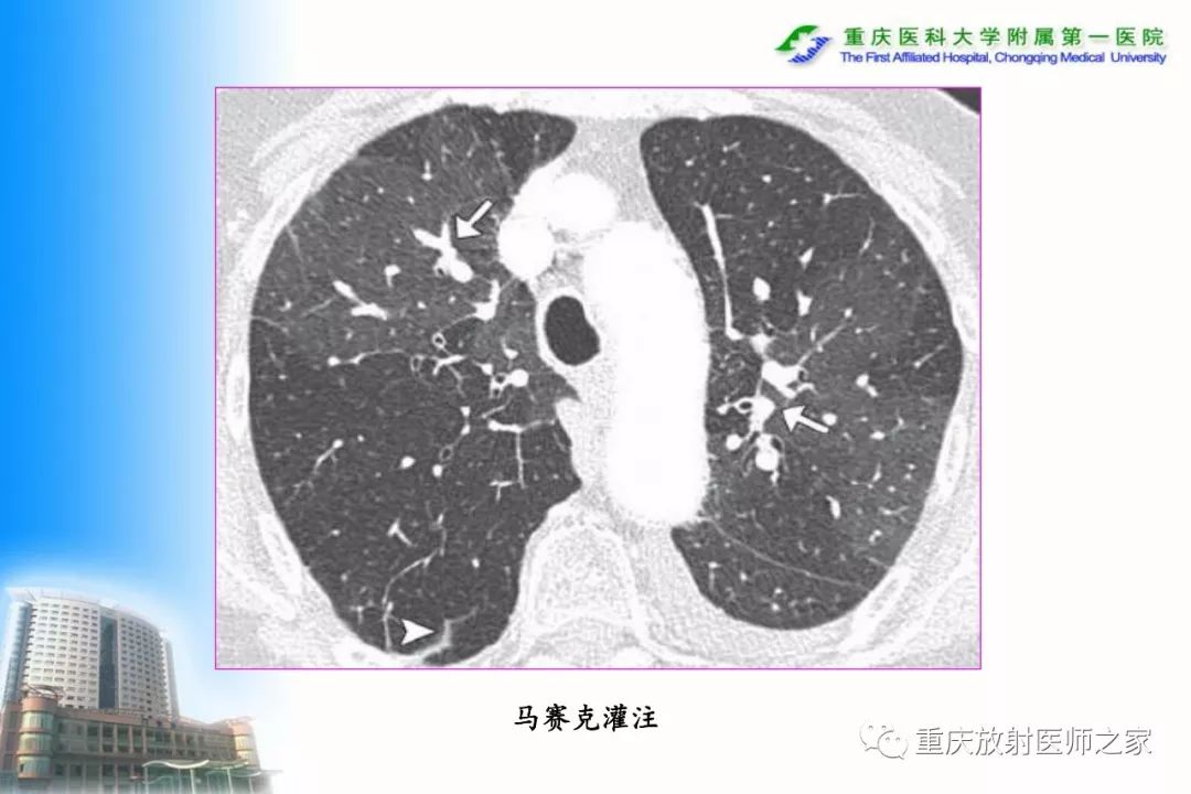 影像PPT - 【PPT】碘对比剂CT增强的影响因素与临床应用-93