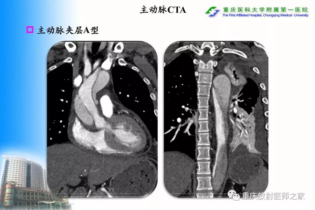 影像PPT - 【PPT】碘对比剂CT增强的影响因素与临床应用-98