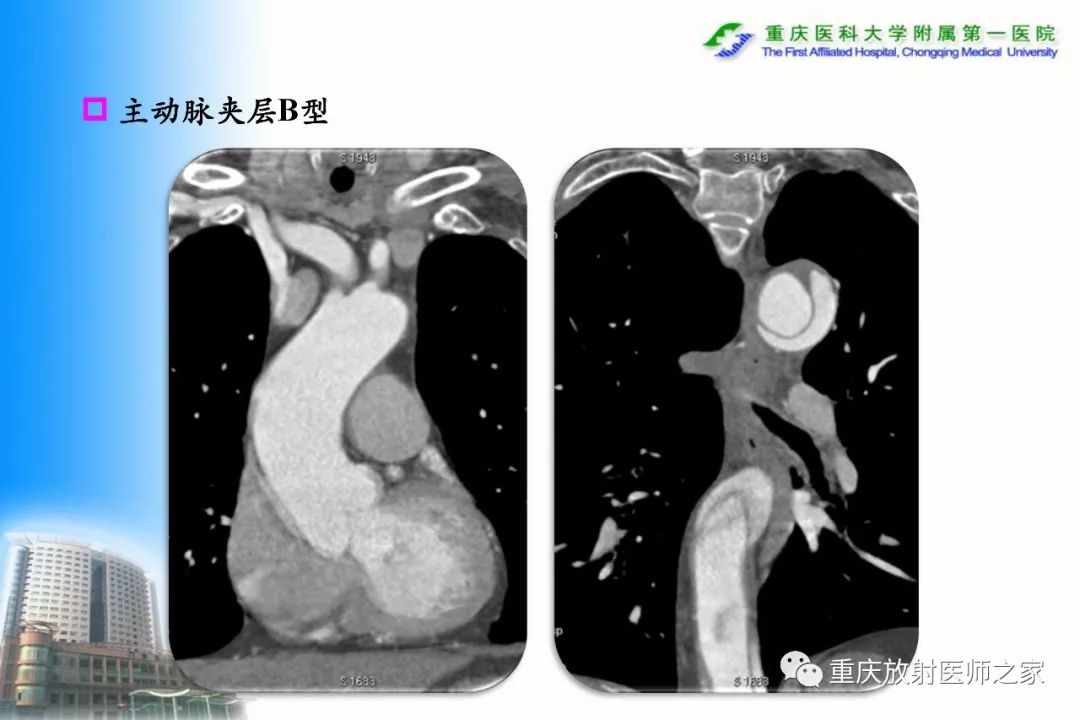 影像PPT - 【PPT】碘对比剂CT增强的影响因素与临床应用-99