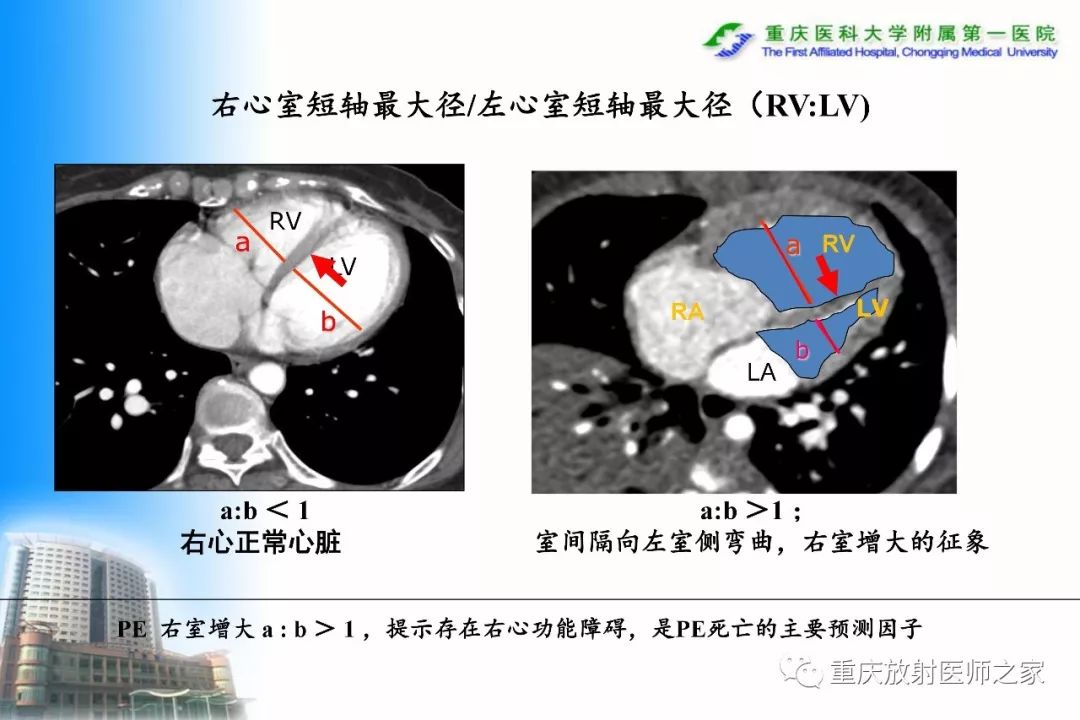 影像PPT - 【PPT】碘对比剂CT增强的影响因素与临床应用-95