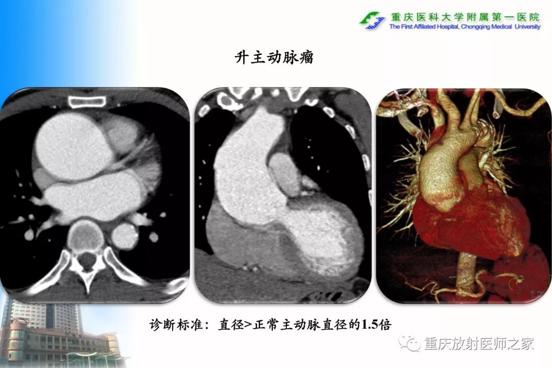 影像PPT - 【PPT】碘对比剂CT增强的影响因素与临床应用-101