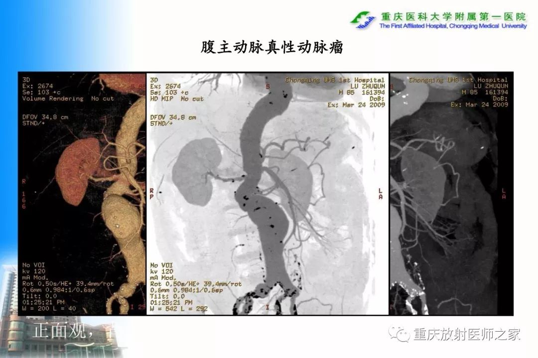 影像PPT - 【PPT】碘对比剂CT增强的影响因素与临床应用-103