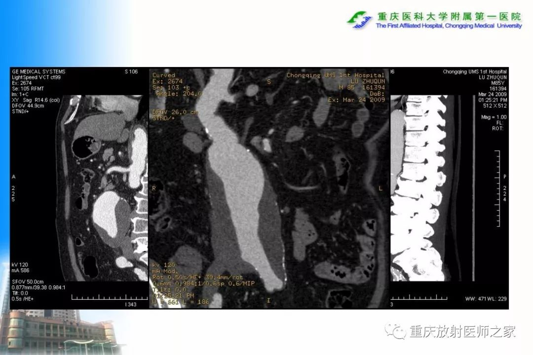影像PPT - 【PPT】碘对比剂CT增强的影响因素与临床应用-104