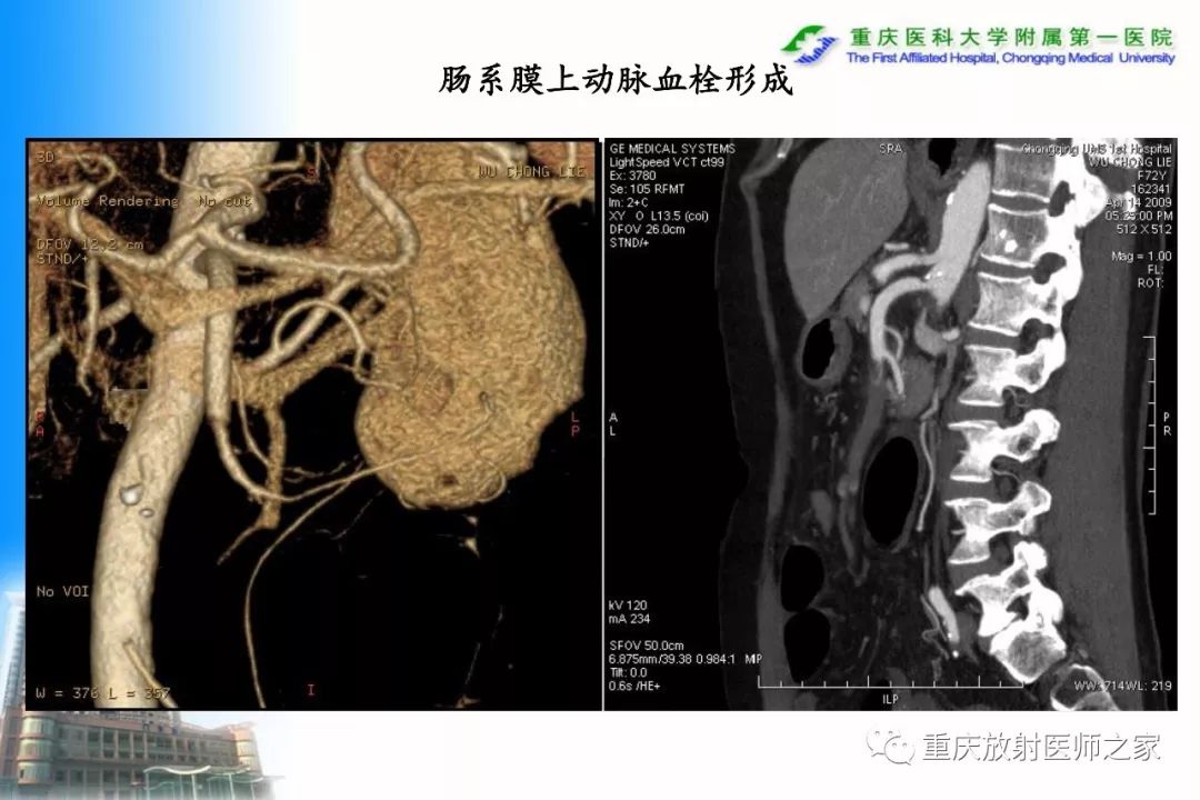 影像PPT - 【PPT】碘对比剂CT增强的影响因素与临床应用-105