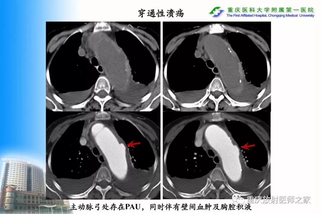 影像PPT - 【PPT】碘对比剂CT增强的影响因素与临床应用-100