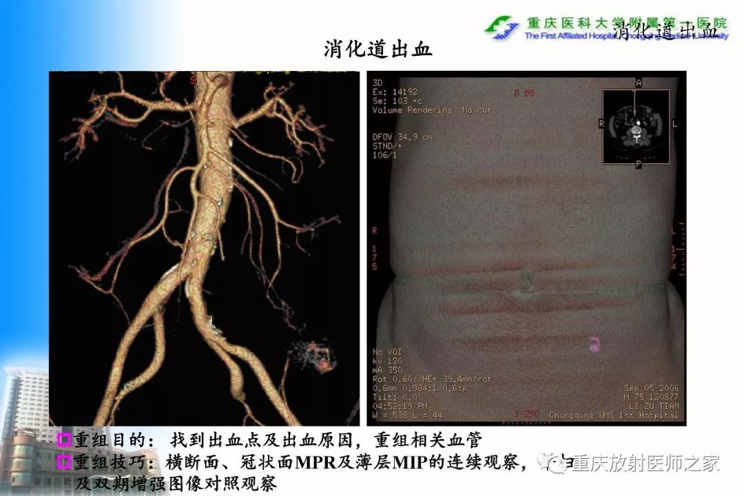 影像PPT - 【PPT】碘对比剂CT增强的影响因素与临床应用-106