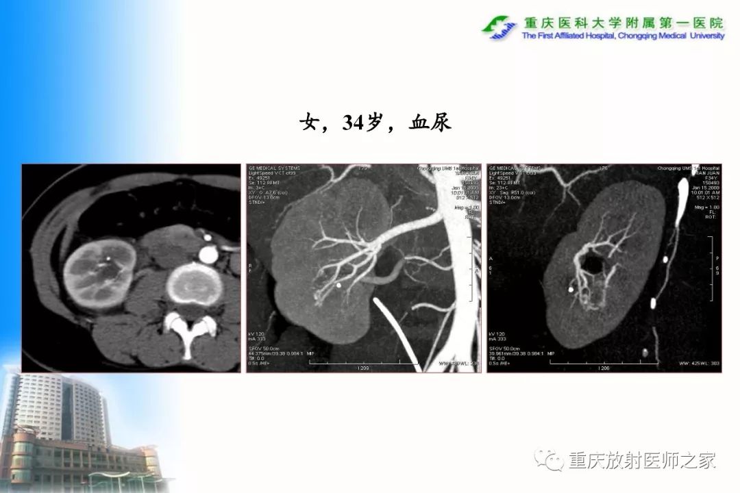影像PPT - 【PPT】碘对比剂CT增强的影响因素与临床应用-112