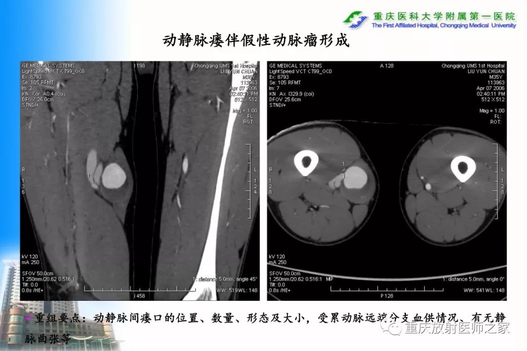影像PPT - 【PPT】碘对比剂CT增强的影响因素与临床应用-118