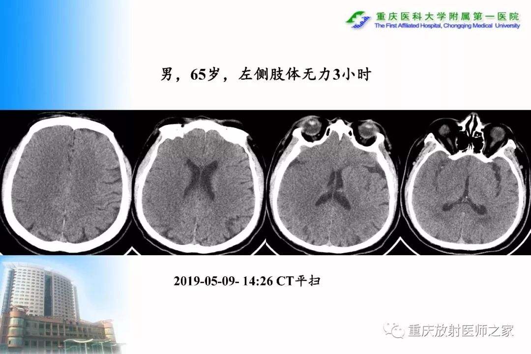 影像PPT - 【PPT】碘对比剂CT增强的影响因素与临床应用-122
