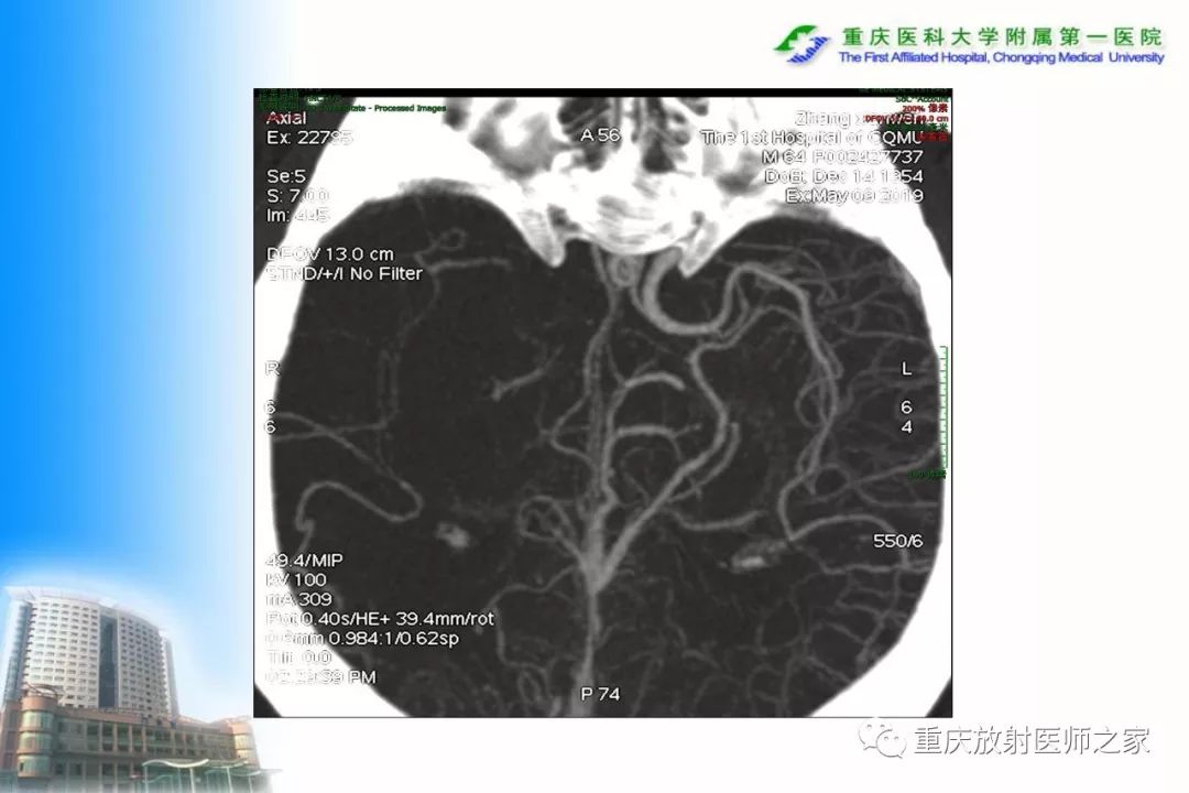 影像PPT - 【PPT】碘对比剂CT增强的影响因素与临床应用-124