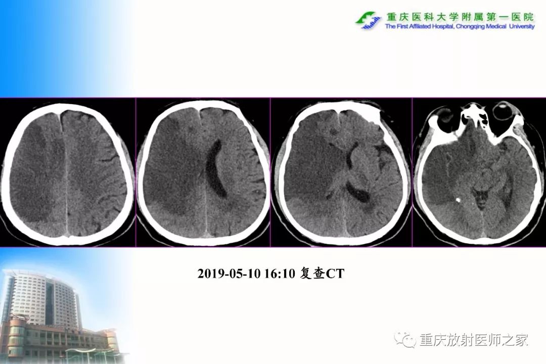 影像PPT - 【PPT】碘对比剂CT增强的影响因素与临床应用-125