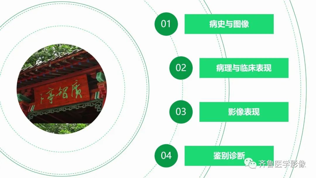 影像PPT - 【病例】上颌窦腺样囊性癌2例CT及MR影像鉴别-2