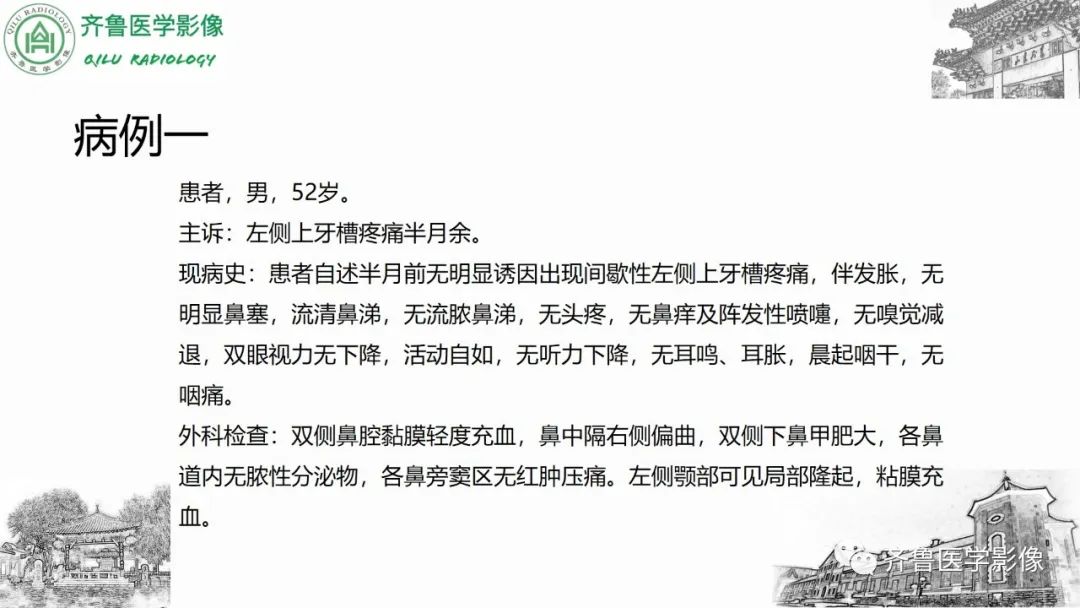 影像PPT - 【病例】上颌窦腺样囊性癌2例CT及MR影像鉴别-3
