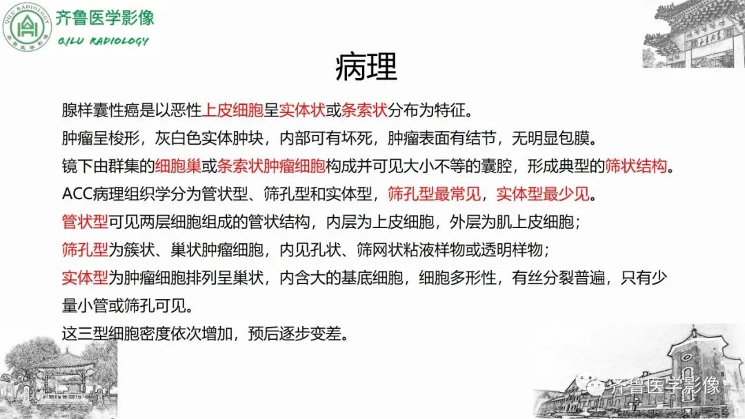 影像PPT - 【病例】上颌窦腺样囊性癌2例CT及MR影像鉴别-19