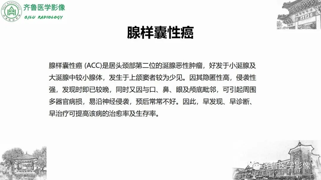 影像PPT - 【病例】上颌窦腺样囊性癌2例CT及MR影像鉴别-17