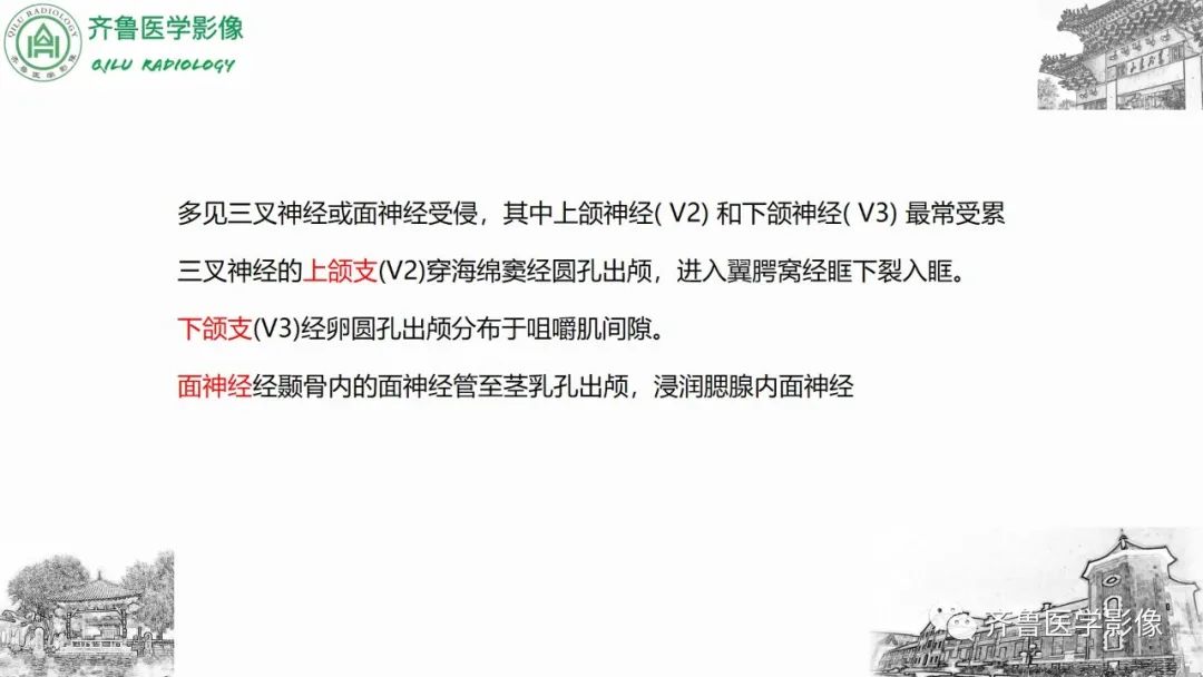 影像PPT - 【病例】上颌窦腺样囊性癌2例CT及MR影像鉴别-23