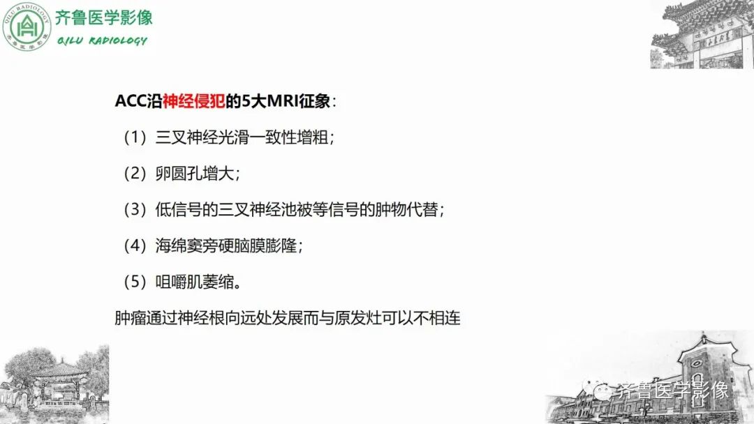 影像PPT - 【病例】上颌窦腺样囊性癌2例CT及MR影像鉴别-26