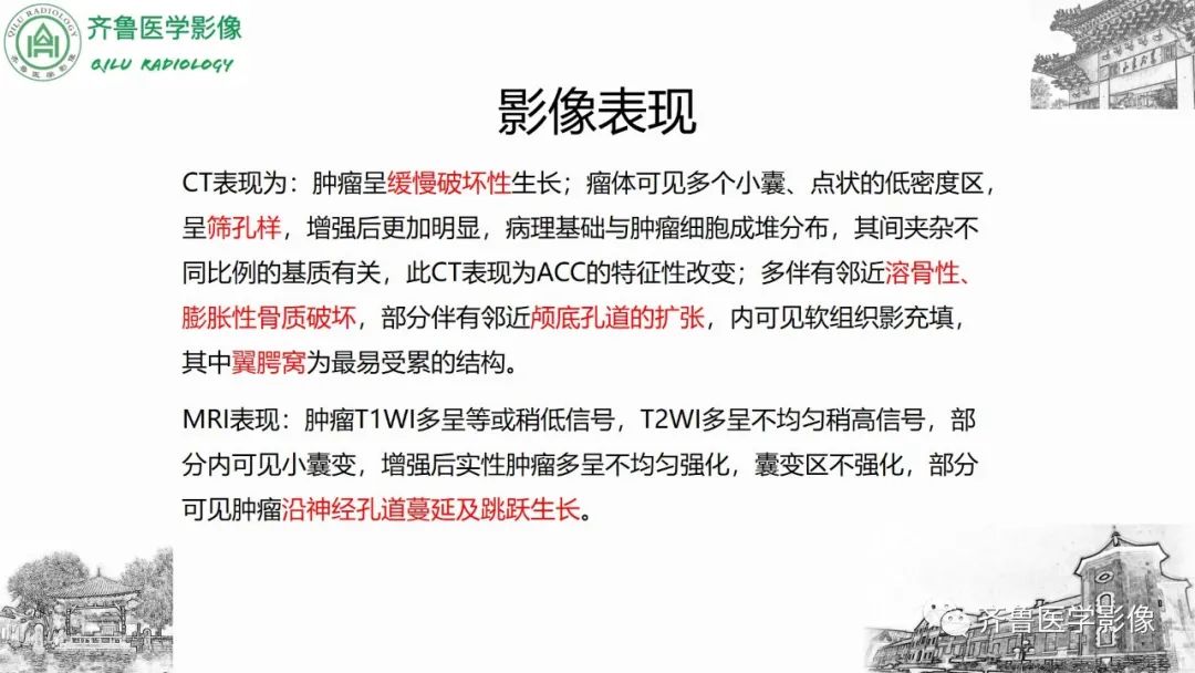 影像PPT - 【病例】上颌窦腺样囊性癌2例CT及MR影像鉴别-22