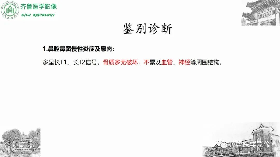 影像PPT - 【病例】上颌窦腺样囊性癌2例CT及MR影像鉴别-35