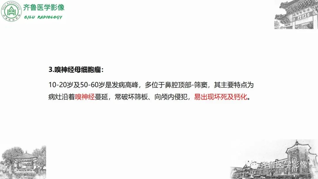 影像PPT - 【病例】上颌窦腺样囊性癌2例CT及MR影像鉴别-38