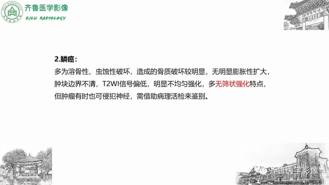 影像PPT - 【病例】上颌窦腺样囊性癌2例CT及MR影像鉴别-36