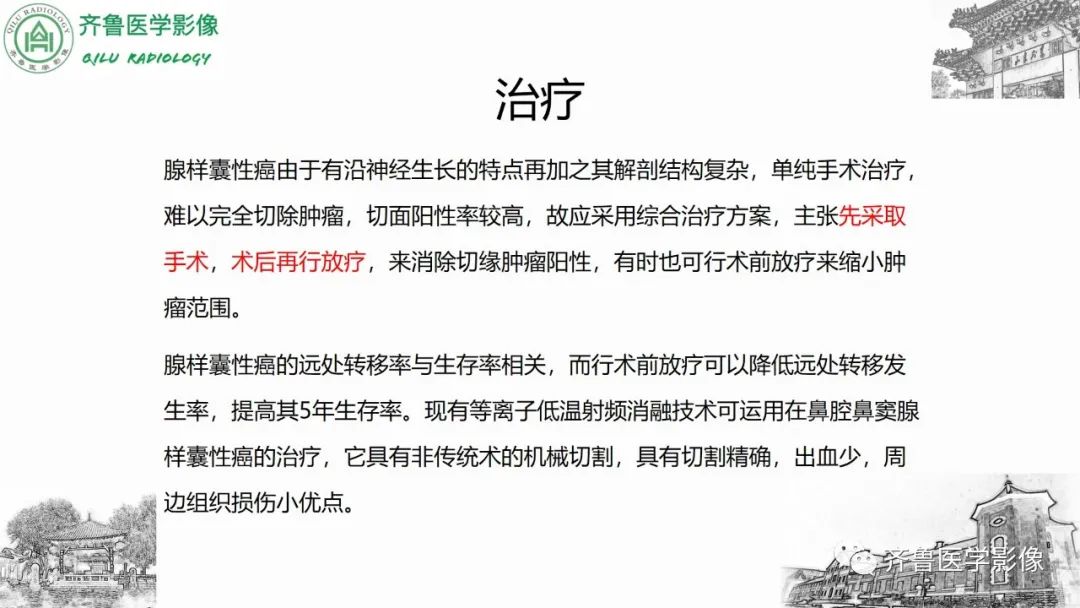 影像PPT - 【病例】上颌窦腺样囊性癌2例CT及MR影像鉴别-46
