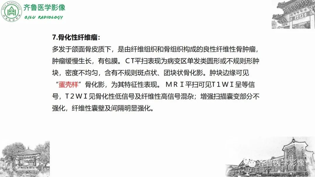 影像PPT - 【病例】上颌窦腺样囊性癌2例CT及MR影像鉴别-43