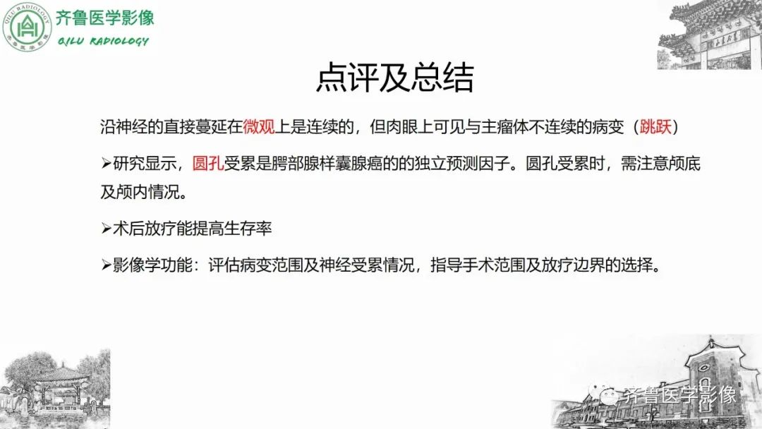 影像PPT - 【病例】上颌窦腺样囊性癌2例CT及MR影像鉴别-49