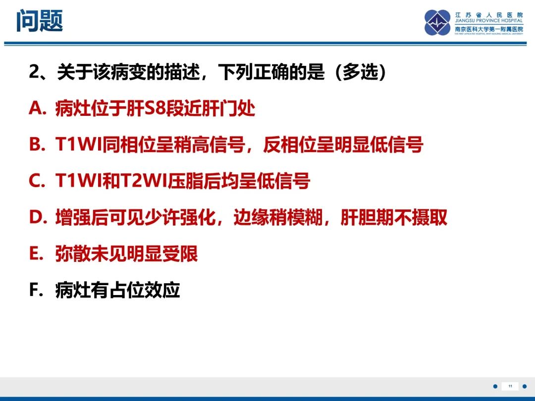 影像PPT - 【PPT】化疗相关性肝脂肪变性-12