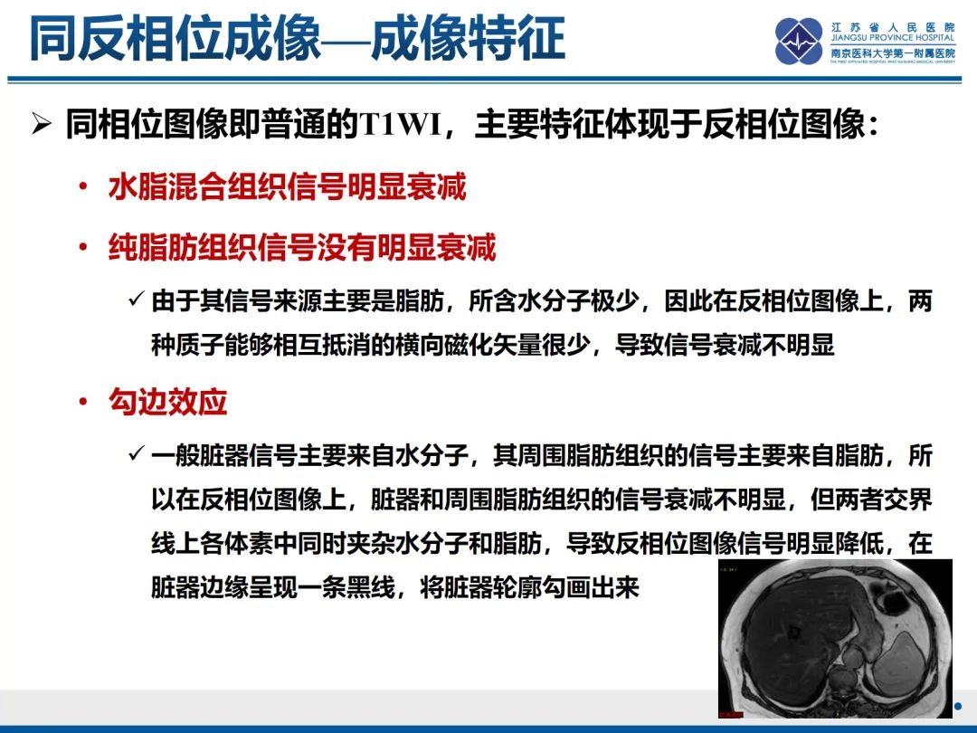 影像PPT - 【PPT】化疗相关性肝脂肪变性-16