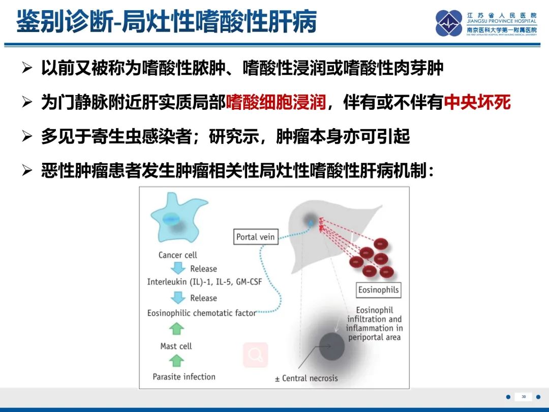 影像PPT - 【PPT】化疗相关性肝脂肪变性-31