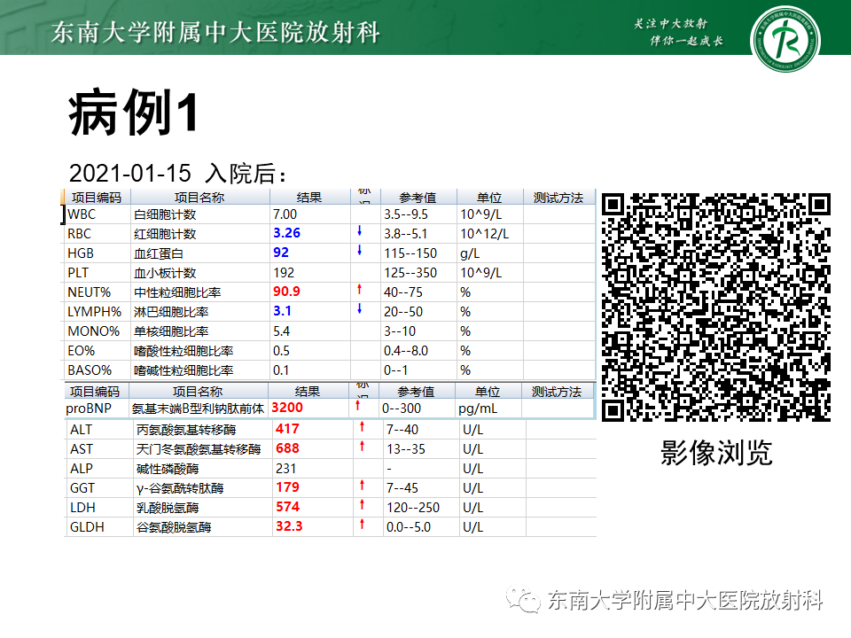 影像PPT - 【PPT】肺间质疾病相关影像鉴别-2
