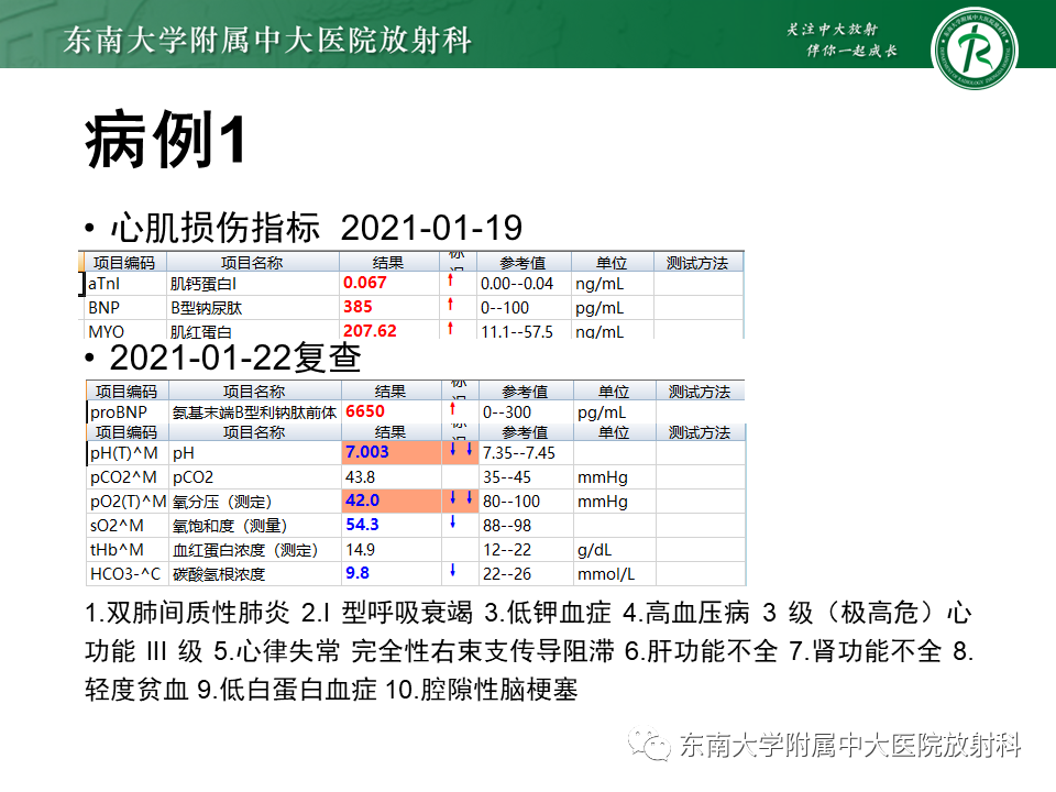 影像PPT - 【PPT】肺间质疾病相关影像鉴别-6