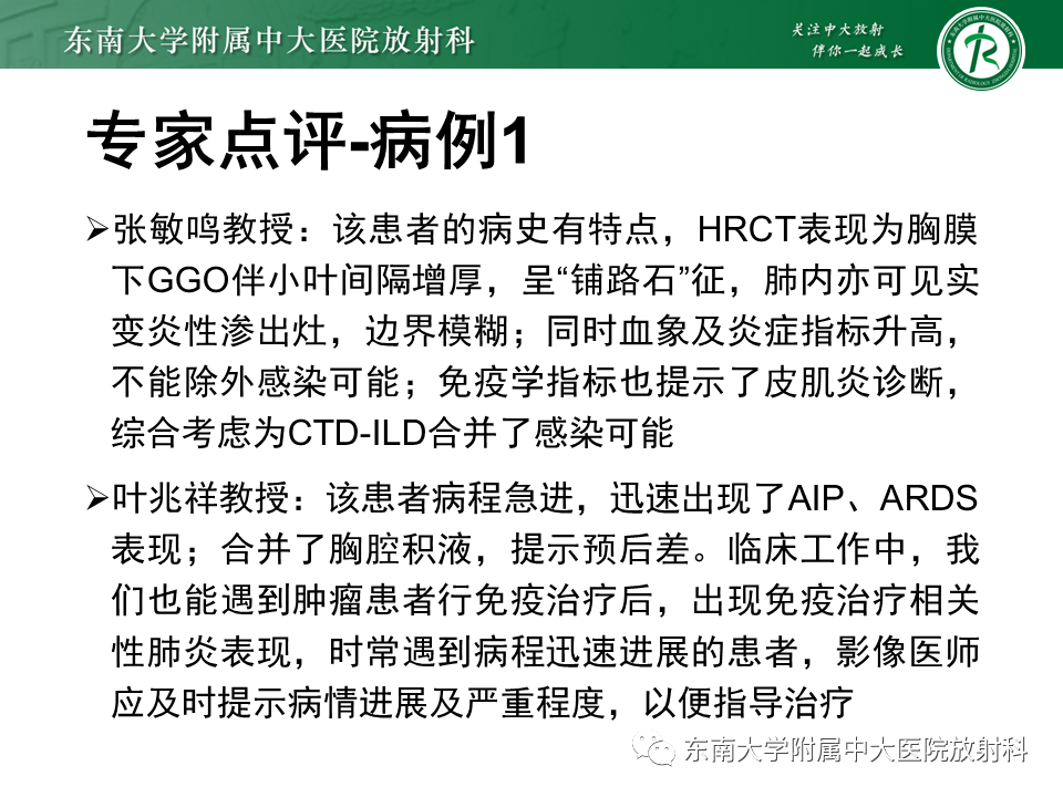影像PPT - 【PPT】肺间质疾病相关影像鉴别-9