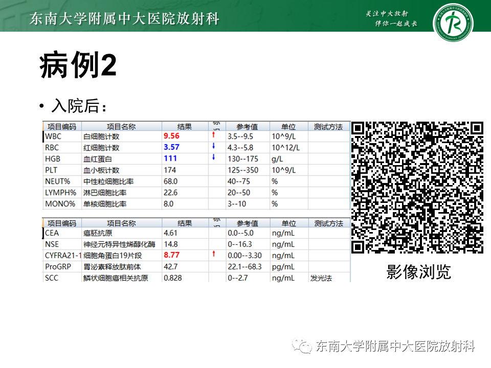 影像PPT - 【PPT】肺间质疾病相关影像鉴别-11