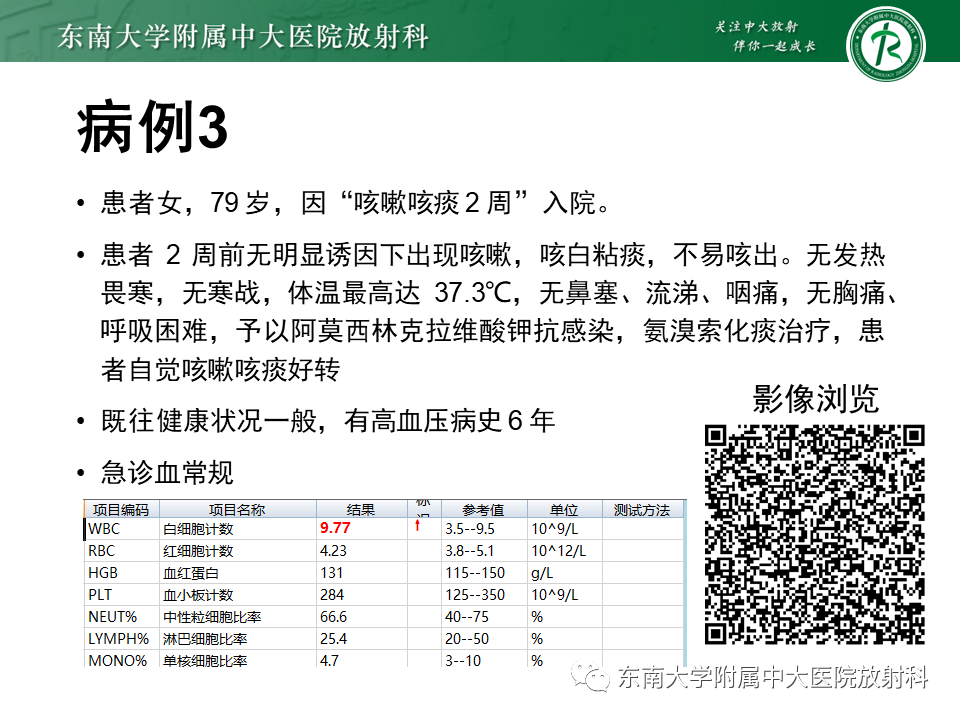 影像PPT - 【PPT】肺间质疾病相关影像鉴别-16